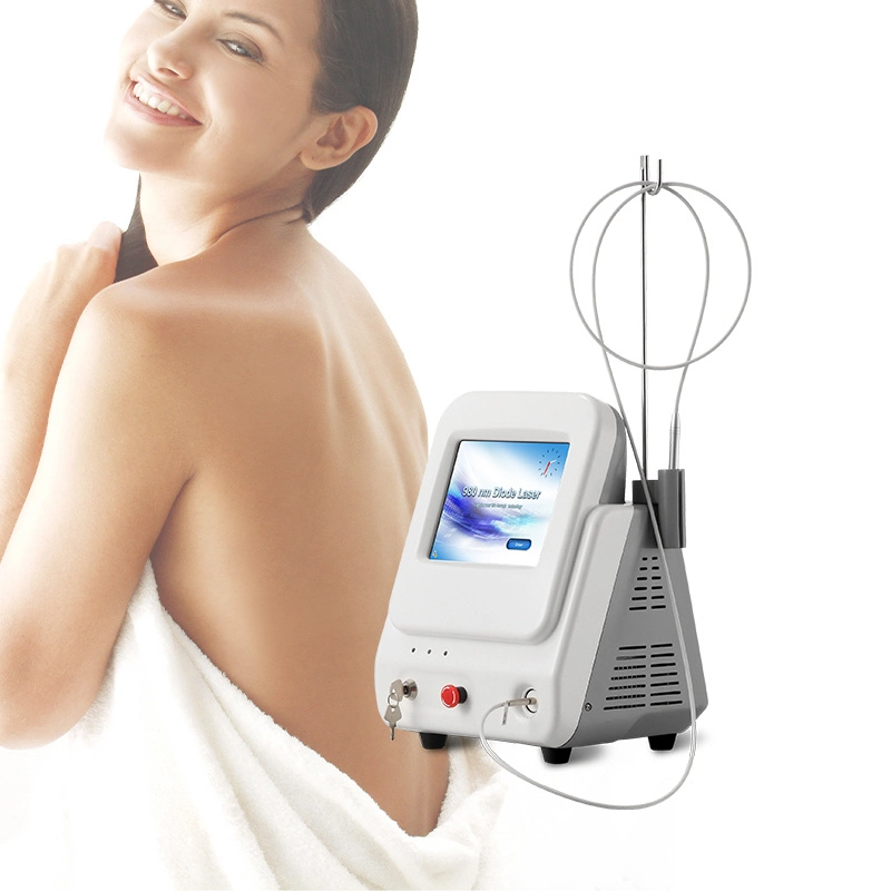 FDA Approved 980nm Laser Spider Veins Removal with Good Treatment Result for Blood Vessels